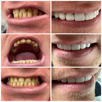 Dental Dialog to Centrum Stomatologii Cyfrowej. Wykonujemy implanty, korony